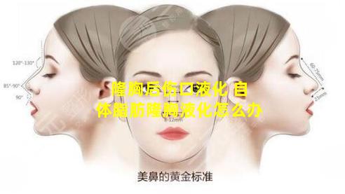 隆胸后伤口液化 自体脂肪隆胸液化怎么办